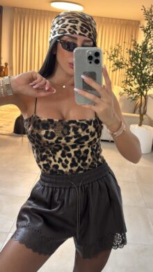 ⁦בגד גוף מנומר⁩ – תמונה ⁦2⁩